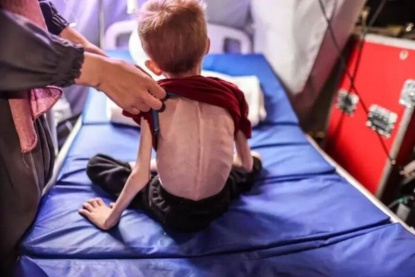 وزارة الصحة فی غزة: 650 ألف طفل على حافة الموت